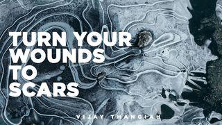 Turn Your Wounds Into Scars John 5:8 English Standard Version 2016