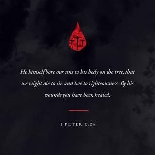 1 Peter 2:24 - Christ carried our sins in his body on the cross so we would stop living for sin and start living for what is right. And you are healed because of his wounds.