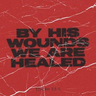 Isaiah 53:5 - But he was wounded for our transgressions, he was bruised for our iniquities: the chastisement of our peace was upon him; and with his stripes we are healed.